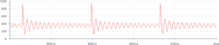 Screenshot of component ZoomBrush single